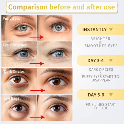 Under Eye Patches - 60 Pcs - 24K Gold Eye Mask- Puffy Eyes & Dark Circles Treatments,Reduce under Eye Bags and Smooth Wrinkles,Eye Skin Care Pads with Collagen,Hyaluronic Acid & Castor Oil